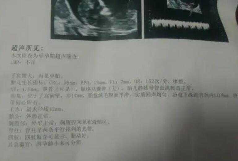 广州可以做三代试管婴儿的医院有哪些 广州试管婴儿流程是怎样的需要多长时