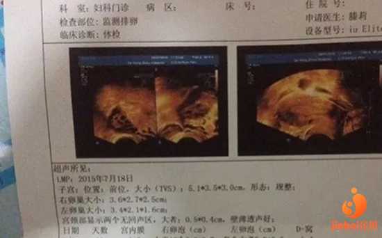 广州最好代怀公司|【广州中山医院供卵试管】生产报喜，二胎分享，二剖没有